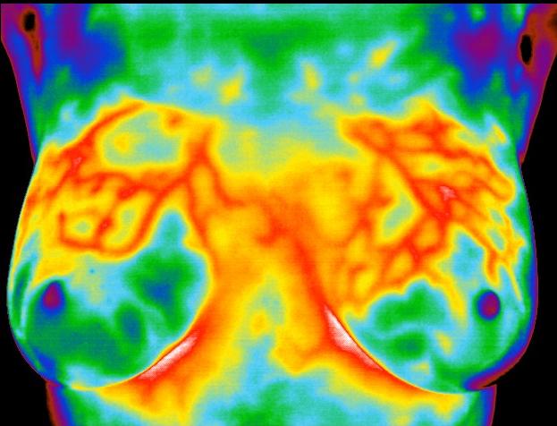 thermogram no. 4
